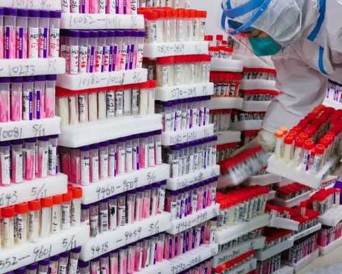 熊猫血怀孕危害-熊猫血怀孕对宝宝的危害