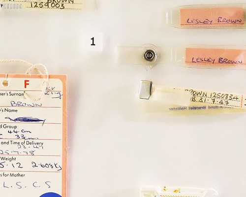 重庆供卵代生双胞胎套餐 重庆做试管婴儿包成功套餐的费用要多少钱 ‘*彩超报