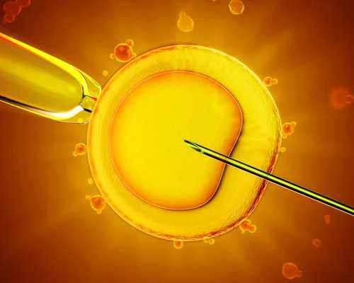 自助赴俄罗斯做试管需要多少费用？