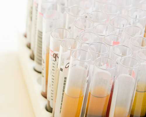 胚胎停止发育的前兆是不是只有腰疼？