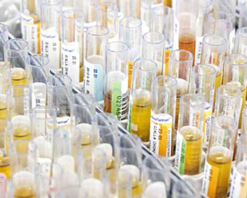 澳大利亚最简单的移民【澳大利亚2026财年移民计划出炉：总配额16万！】