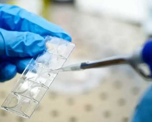 雌二醇取卵：雌二醇取卵后当天会大幅下降吗？