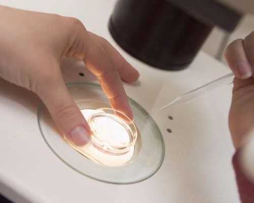 B超检查注意事项，人手一份,试管助孕中介